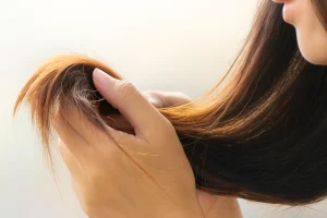 Kenali Penyebab Rambut Rontok dari Kulit Kepala Berminyak